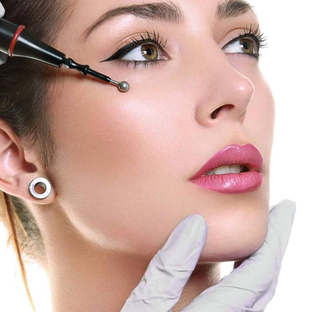 microlifting senza bisturi legnano