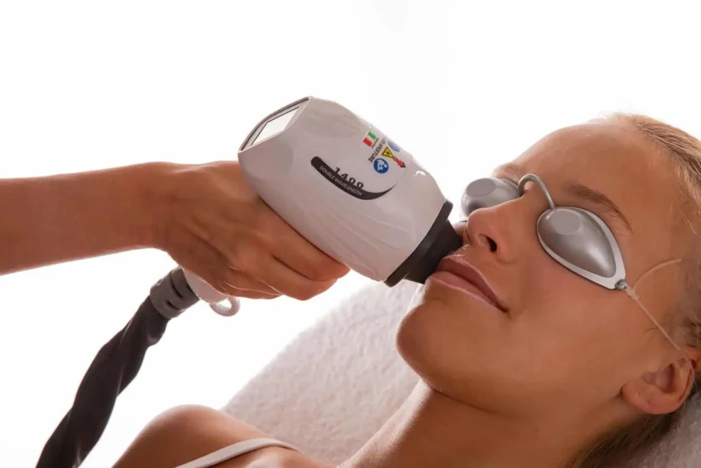 lase legnano epilazione laser legnano